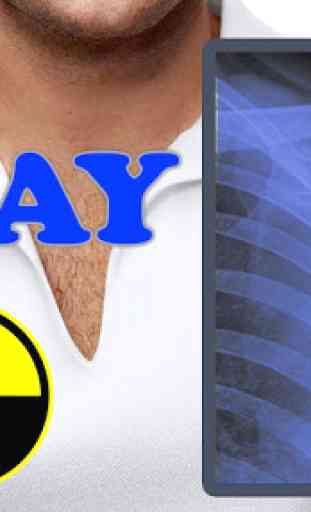 X-Ray Body Scanner Prank 3