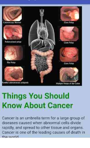 Know about CANCER Disease 3