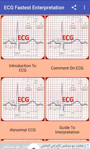 ECG Interpretation Made Easy 1