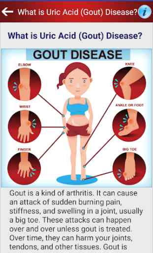 Arthritis Gout Uric Acid Diet 2