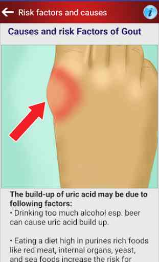 Arthritis Gout Uric Acid Diet 3