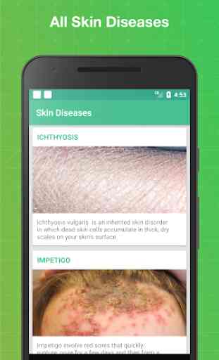 All Skin Diseases and Treatments - Skin care guide 1