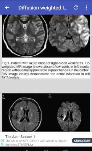 Magnetic Resonance Imaging (MRI) Sequences 3