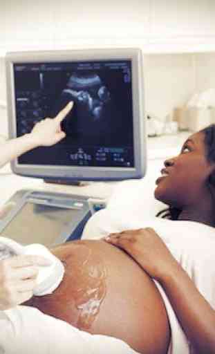 Guide to Ultrasound in Obstetrics and gynecology 2
