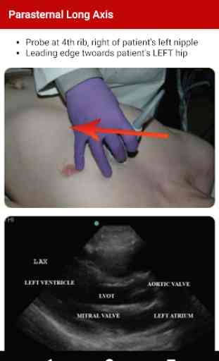 POC Ultrasound Guide 2