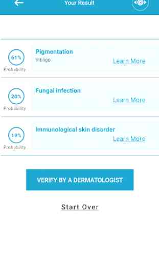 Analyze skin problems | AI Skin Symptom Checker 4
