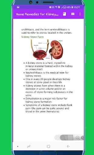 Home Remedies for Kidney Stones 4