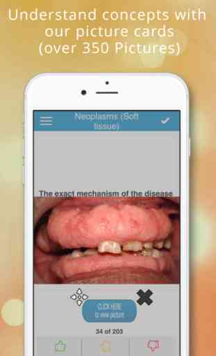 NBDE Dental Board Part 2 - Oral Diagnosis 2