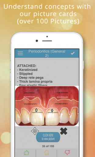NBDE Dental Board Part 2 - Periodontics 2