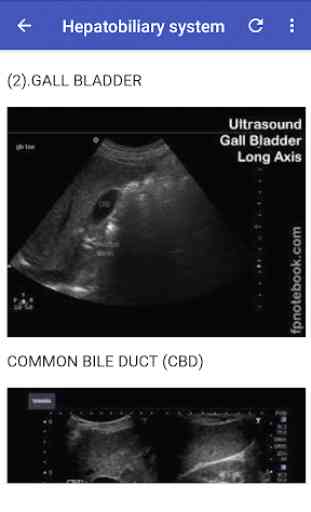 Abdomino-Pelvic Ultrasound Guide 1