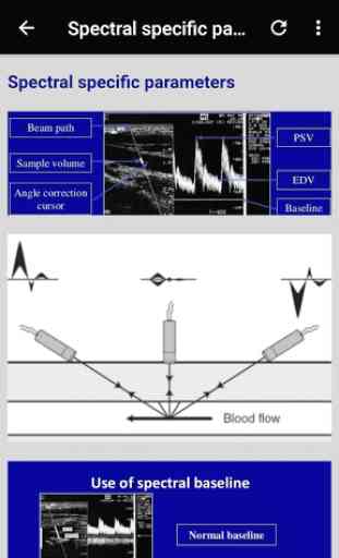 Basic Principles of Doppler Ultrasound - Guide App 4