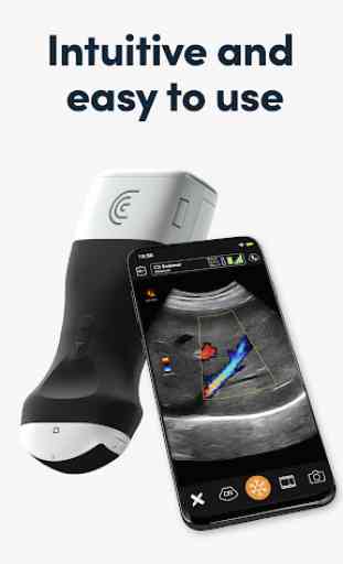 Clarius Ultrasound App 1