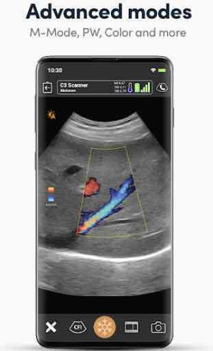 Clarius Ultrasound App 4