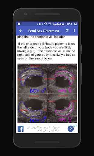 Obstetrics & Gyenacology Ultrasound Guide 1