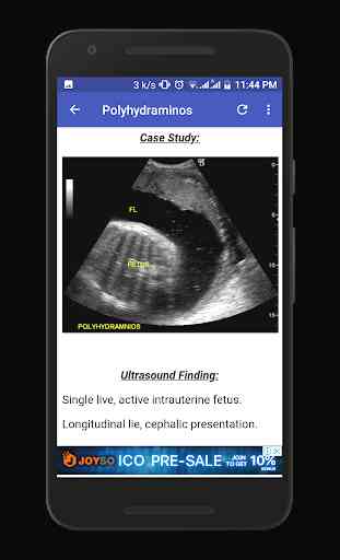 Obstetrics & Gyenacology Ultrasound Guide 4