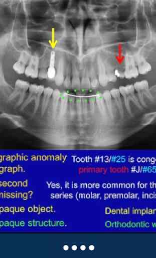 Oral Radiology - SecondLook 2