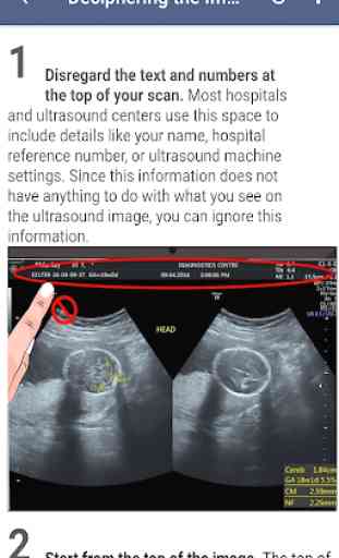 Ultrasound Guide 1