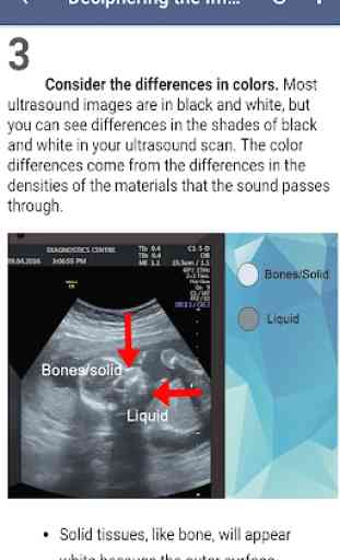 Ultrasound Guide 2