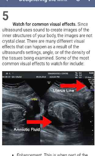 Ultrasound Guide 3