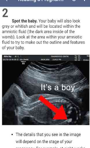 Ultrasound Guide 4