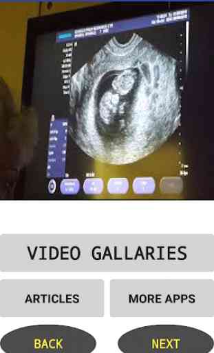 Ultrasound Video 3