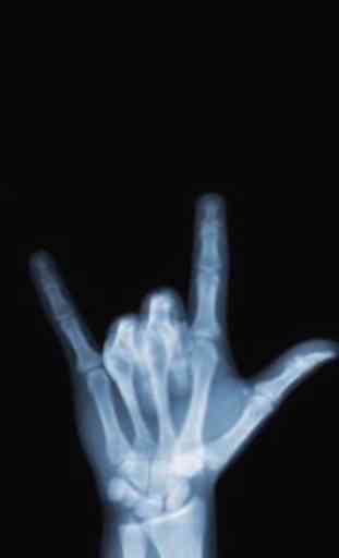 X-Ray Camera Scanner Joke 2