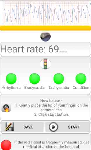 Cardiac diagnosis (heart rate, arrhythmia) 3