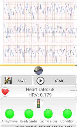 Cardiac diagnosis (heart rate, arrhythmia) 4