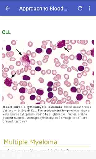 Hematology Overview 3