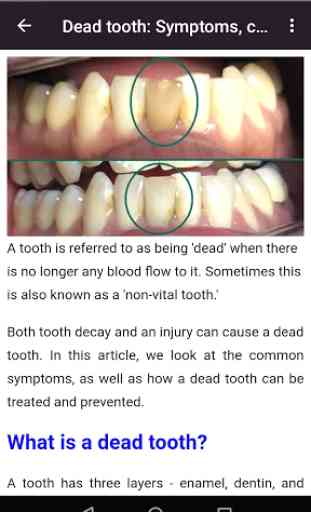 Dental Diseases 4