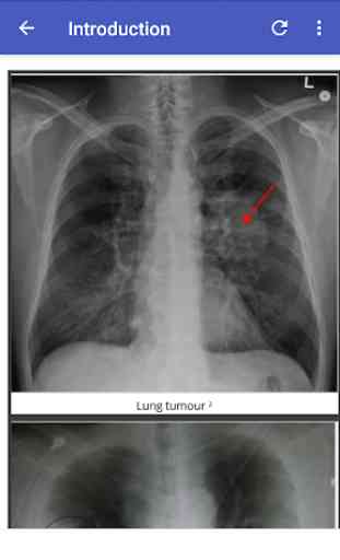 Chest X-Ray Based Cases 2