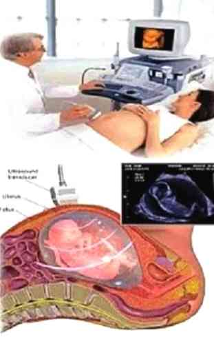 Ultrasound Guide 2