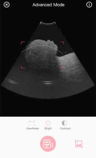 Fetus Camera 2
