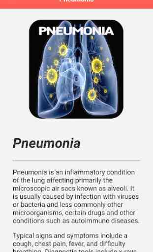 Pneumonia Disease 3