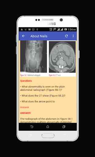Learn Abdominal Radiological Findings 2