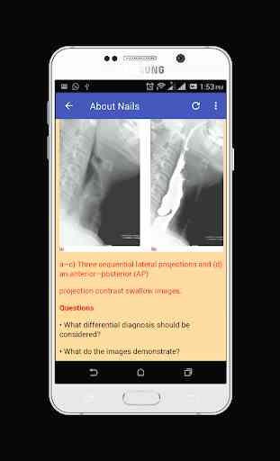Learn Abdominal Radiological Findings 3