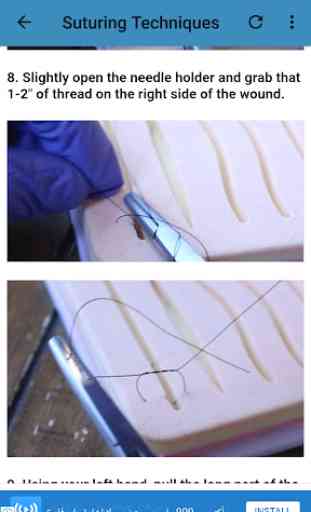 Suture Guidelines 3