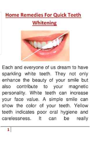 How to Whiten Teeth Instantly 2