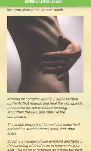 Get rid of STRETCH MARKS - Home Remedies 4