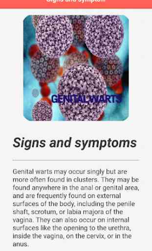 Genitalwarts Infection 4