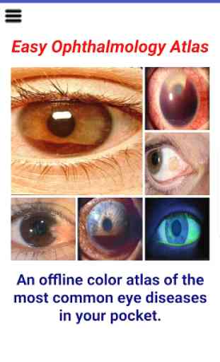 Easy Ophthalmology Atlas 1
