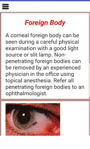 Easy Ophthalmology Atlas 4