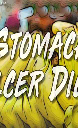 Stomach Ulcer Diet 1