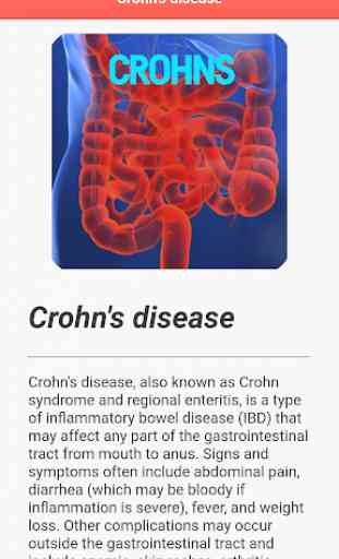 Crohns Disease 3