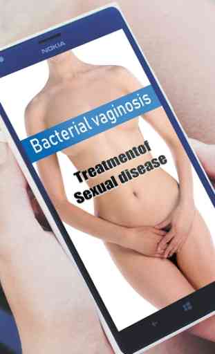 Bacterial Vaginosis (BV)- Treatment Sexual Disease 1