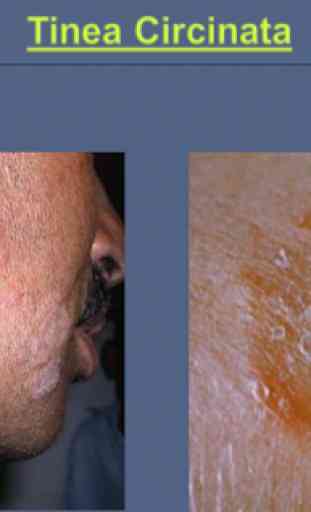 Skin Diseases 3