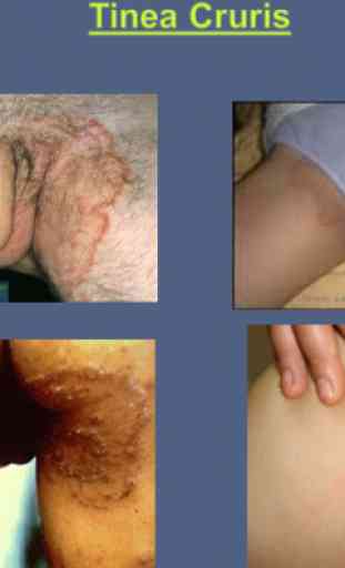 Skin Diseases 4