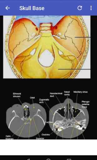 CT Scan Anatomy ATLAS 3