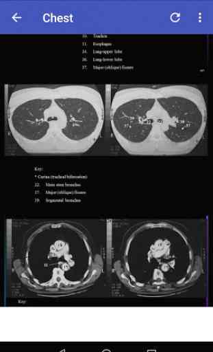 CT Scan Anatomy ATLAS 4