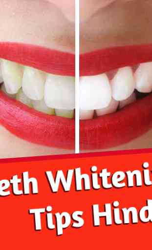 Teeth Whitening Tips Hindi 1